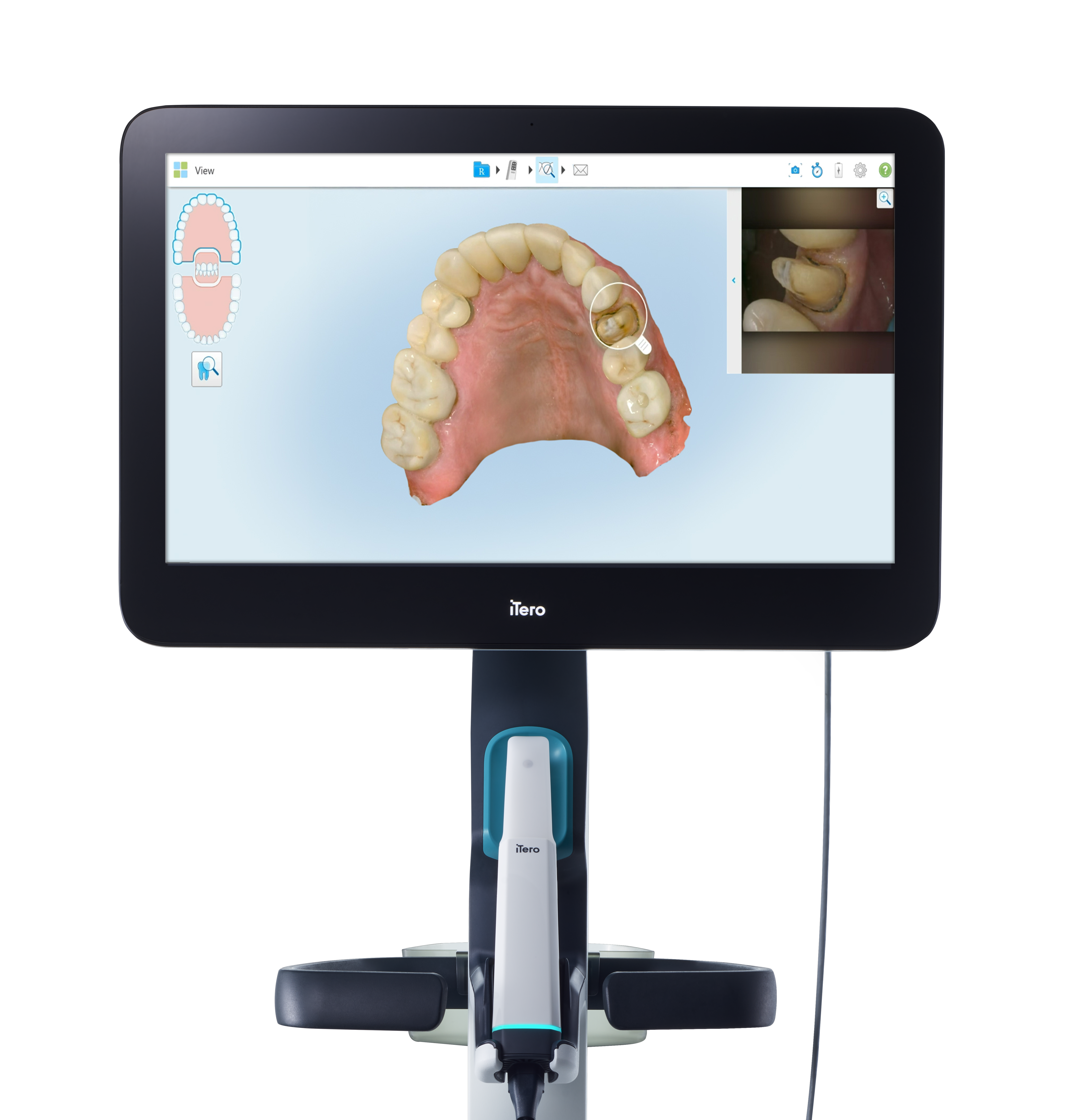 iTero Lumina intraoral scanner at Brammeier Dental of Naperville