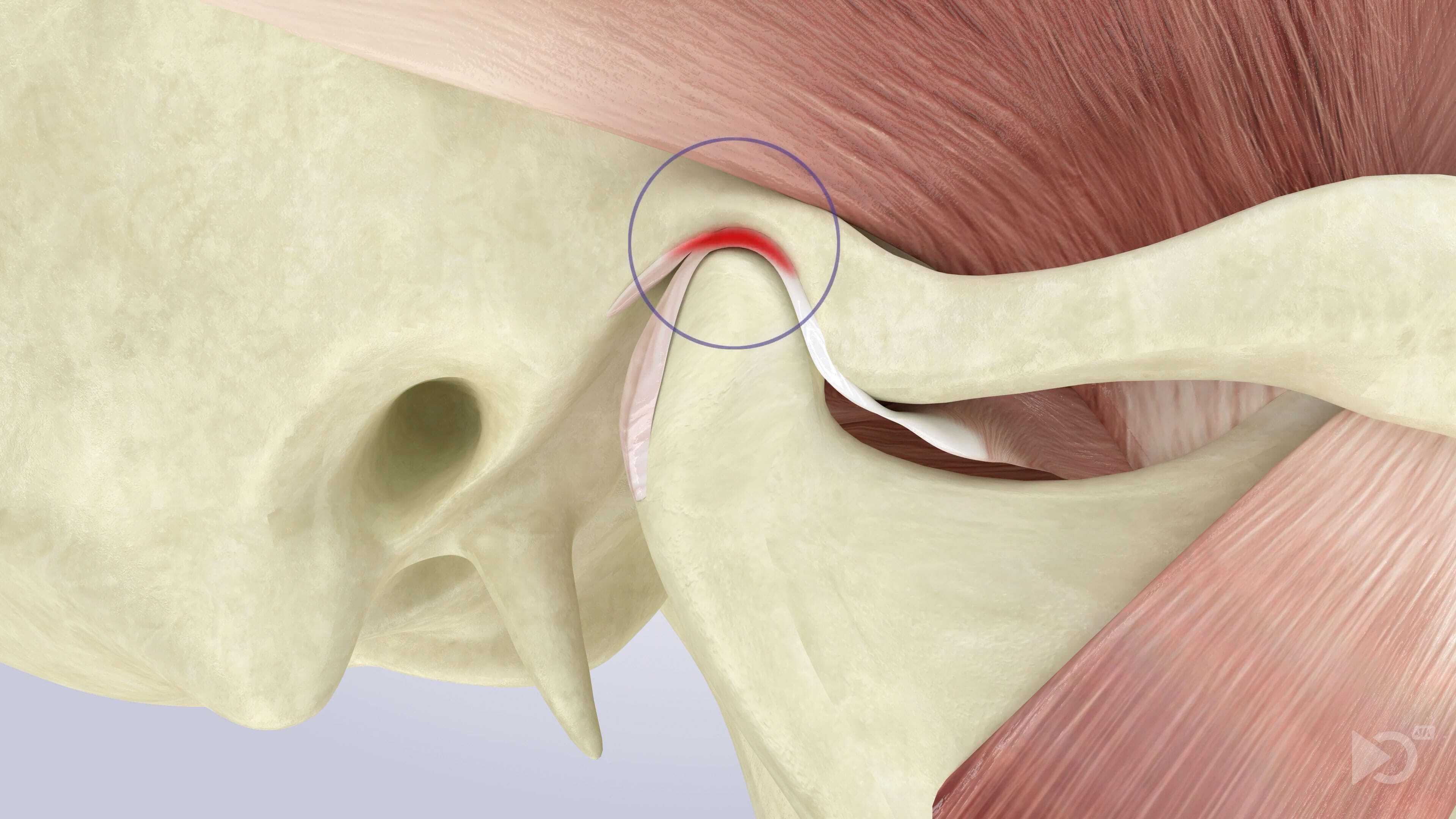 TMJ temporomandibular joint diagram