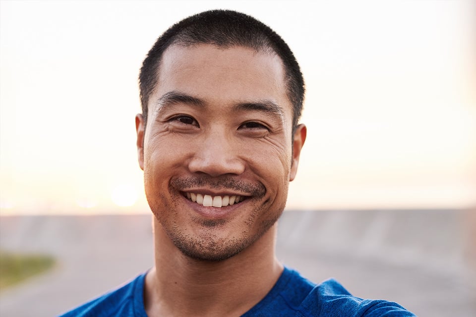 Minimal prep veneers at 